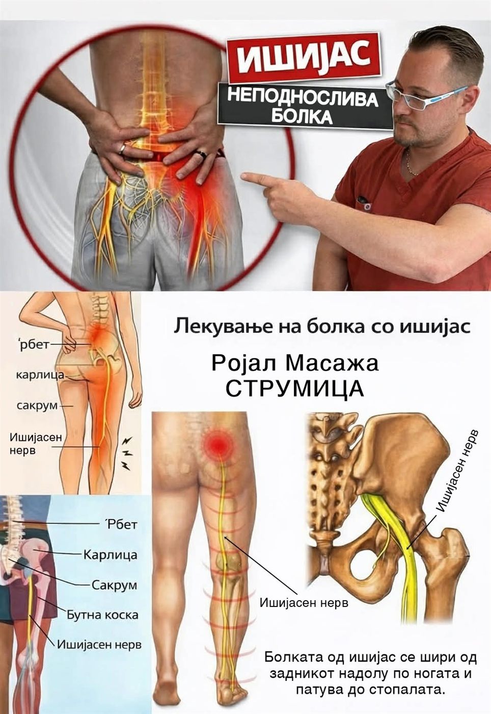 Едукативна графика за ишијас и патот на ишијасниот нерв низ ногата